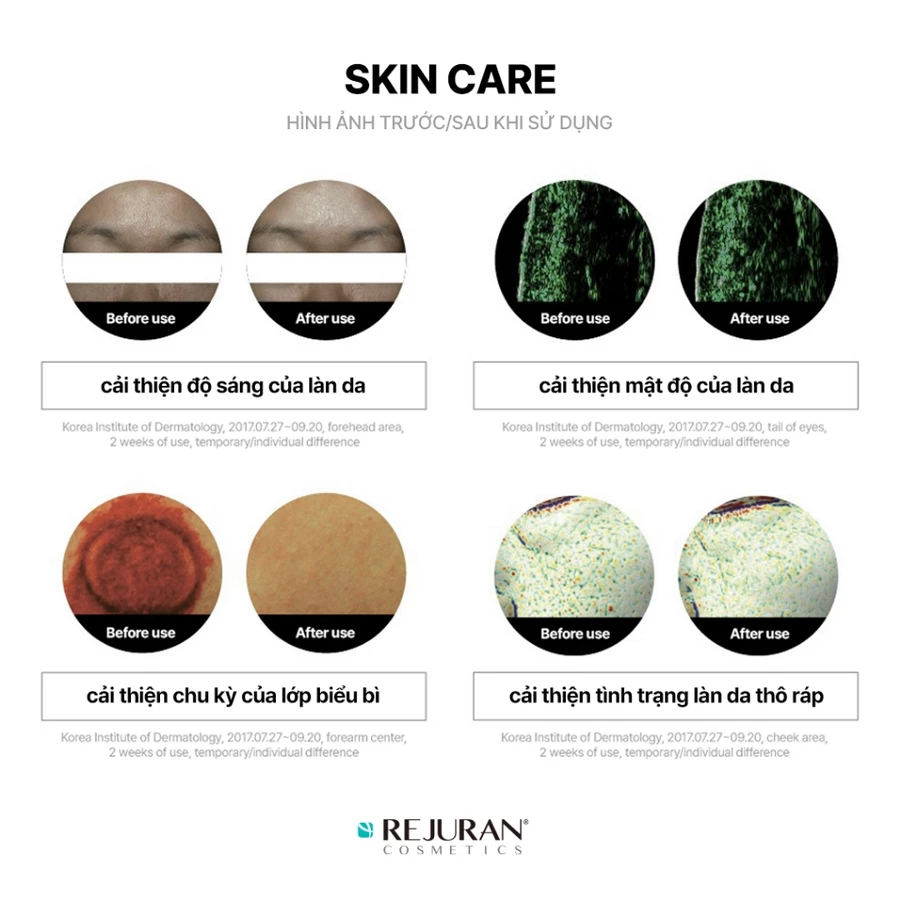 [REJURAN] Tinh Chất Phục Hồi Tái Tạo Sáng Da | Turnover Ampoule 30mL